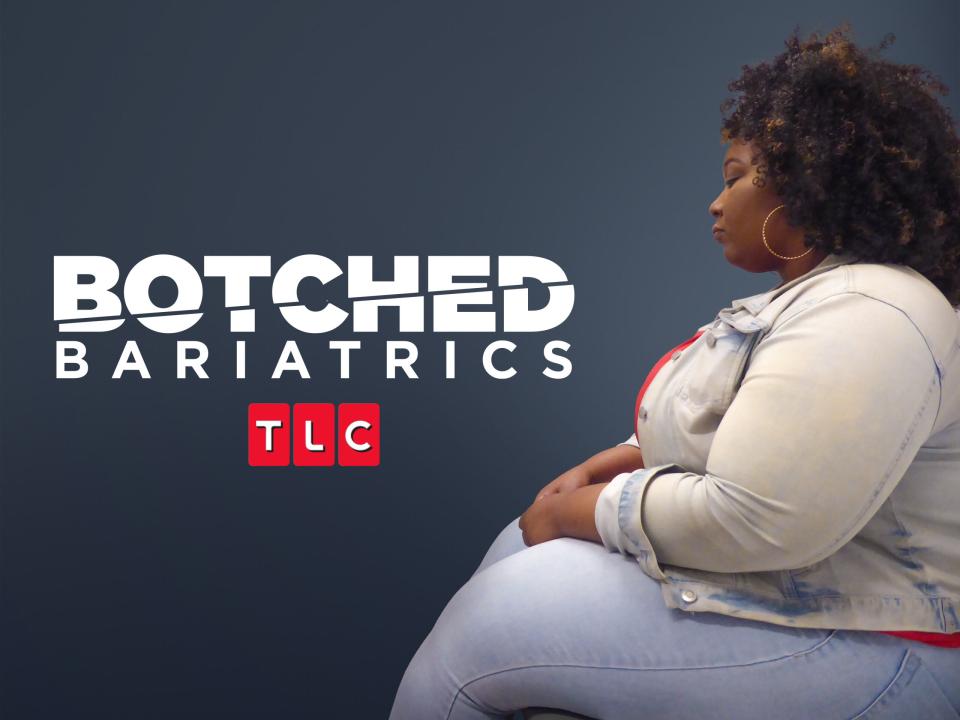 Botched Bariatrics / 16.03.2025, 01:00